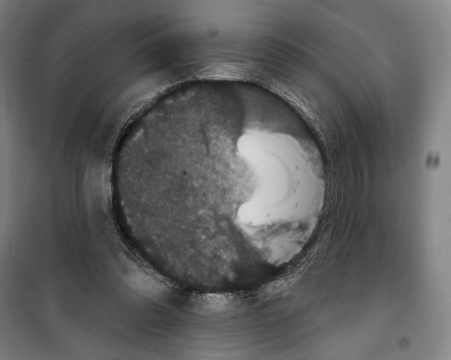X0000099380302200806051127