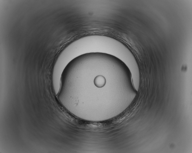 X0000099380317200806051127