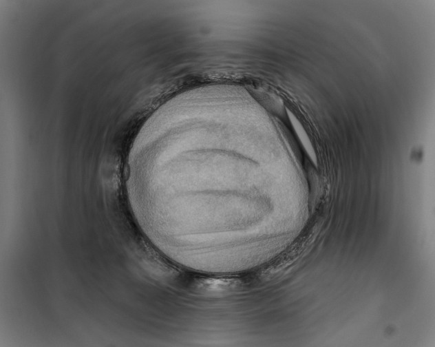 X0000099380323200806051127