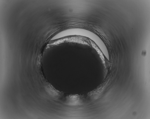 X0000099380325200806051127
