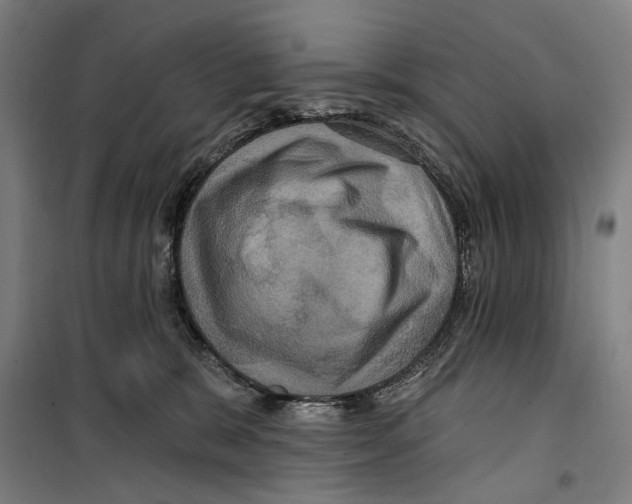 X0000099380327200806051127