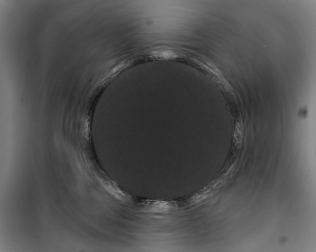 X0000099380330200806051127