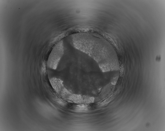 X0000099380335200806051127