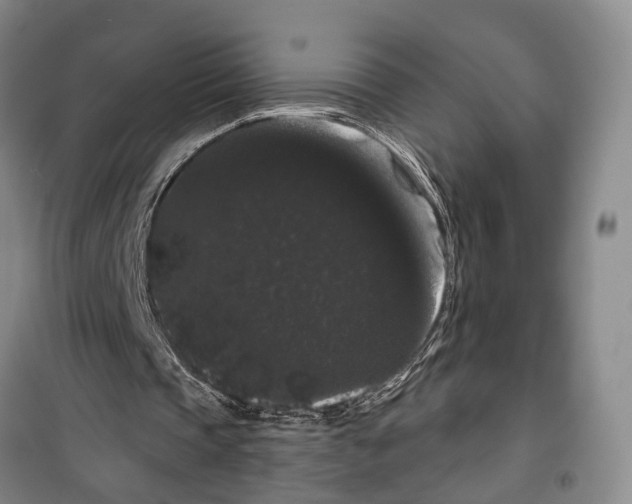 X0000099380337200806051126