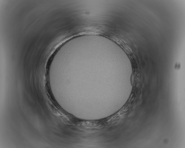 X0000099380338200806051126