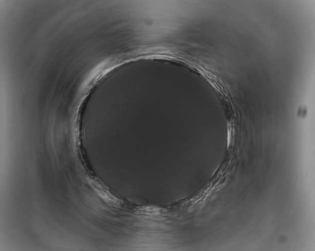 X0000099380339200806051126