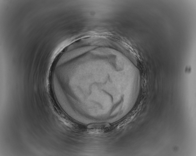 X0000099380340200806051126