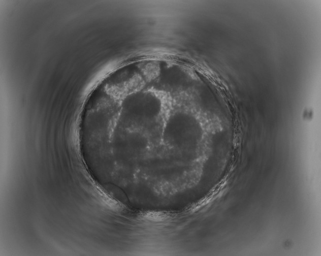 X0000099380341200806051126
