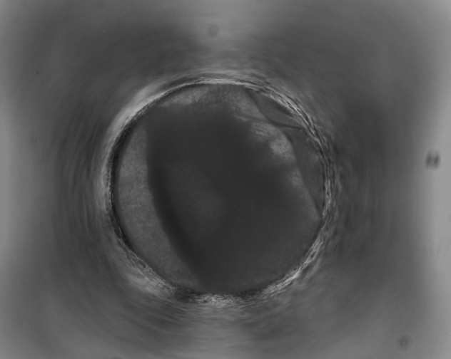 X0000099380343200806051126