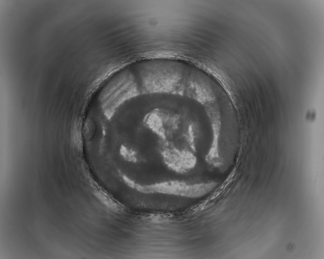 X0000099380345200806051126