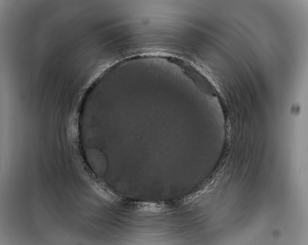 X0000099380347200806051126