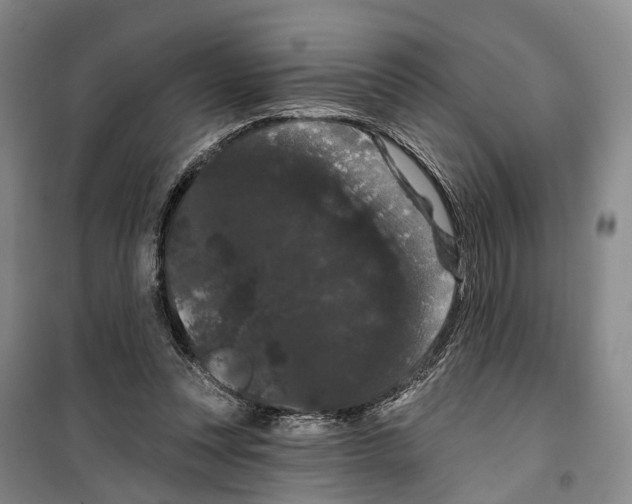 X0000099380351200806051126