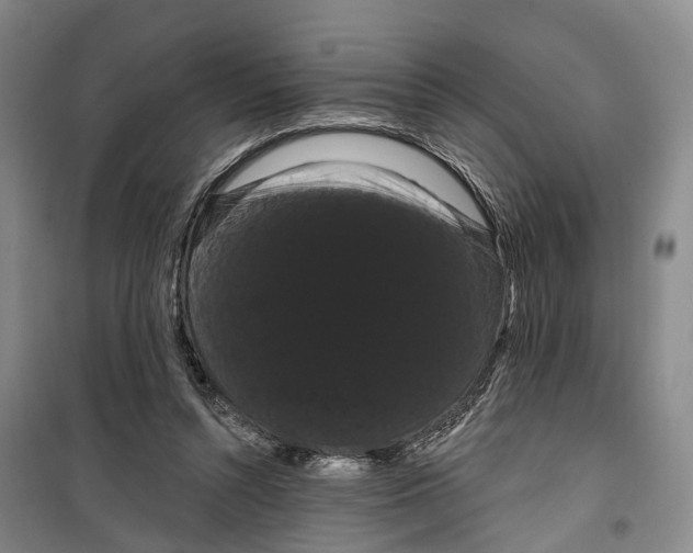 X0000099380352200806051126