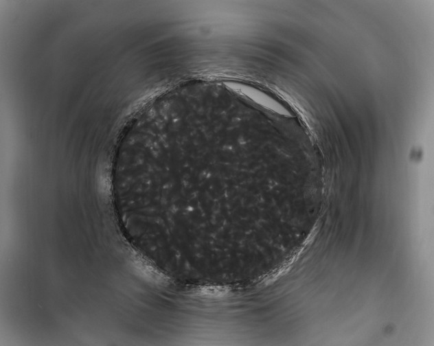 X0000099380353200806051126