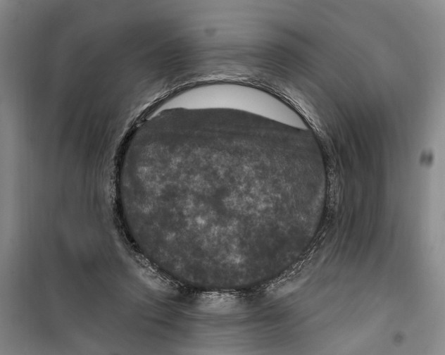 X0000099380354200806051126
