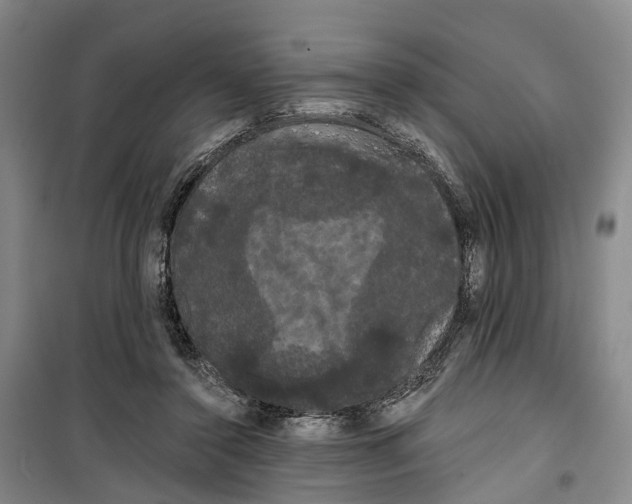 X0000099380356200806051126