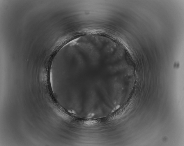 X0000099380357200806051126