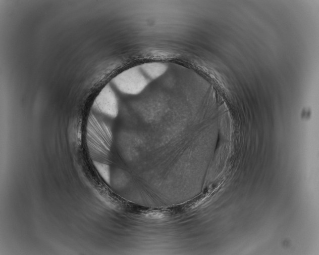X0000099380358200806051126