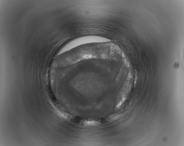 X0000099380360200806051126