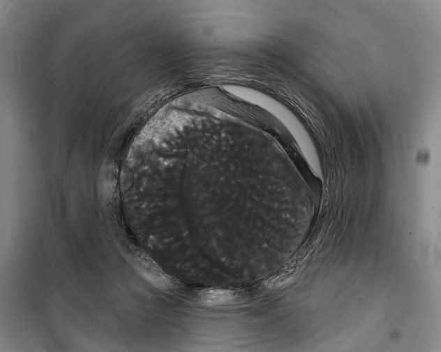 X0000099380361200806051126