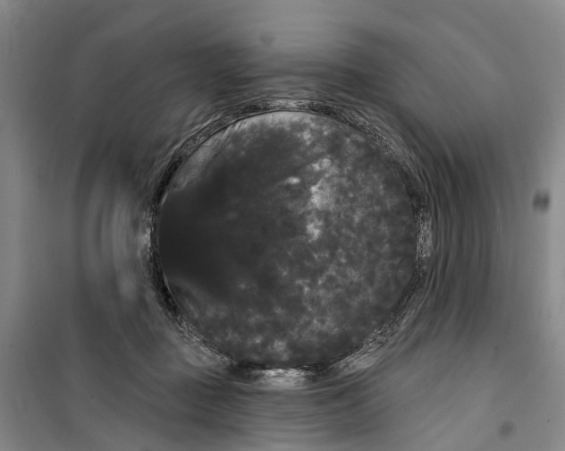 X0000099380363200806051126