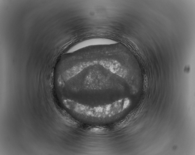 X0000099380364200806051126