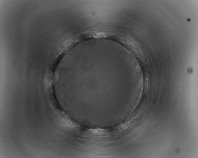 X0000099380367200806051126