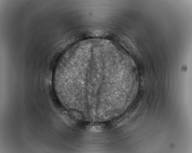 X0000099380368200806051126