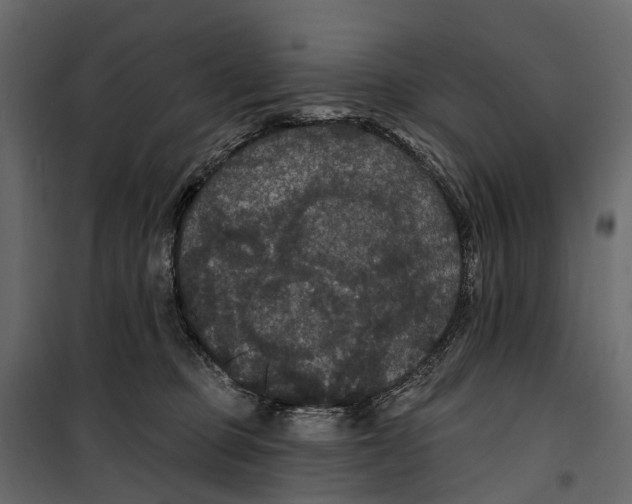 X0000099380373200806051127