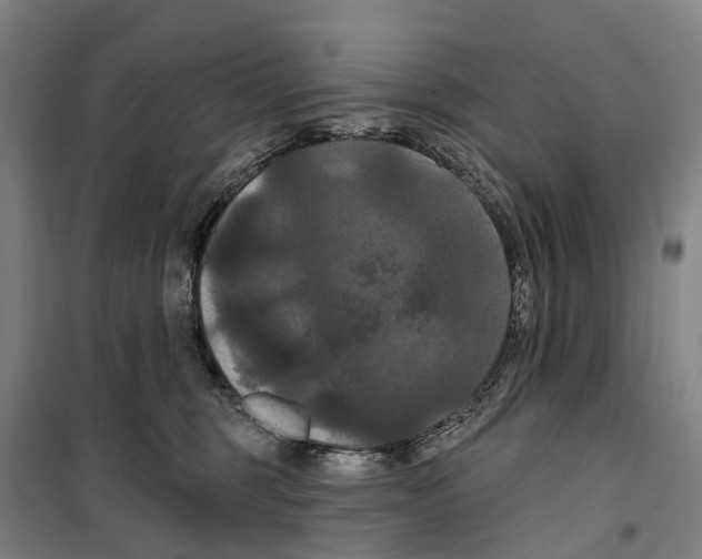X0000099380375200806051127