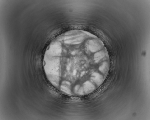X0000099380377200806051127