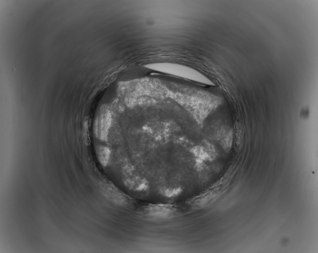 X0000099380378200806051127