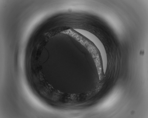 X0000099380383200806051127