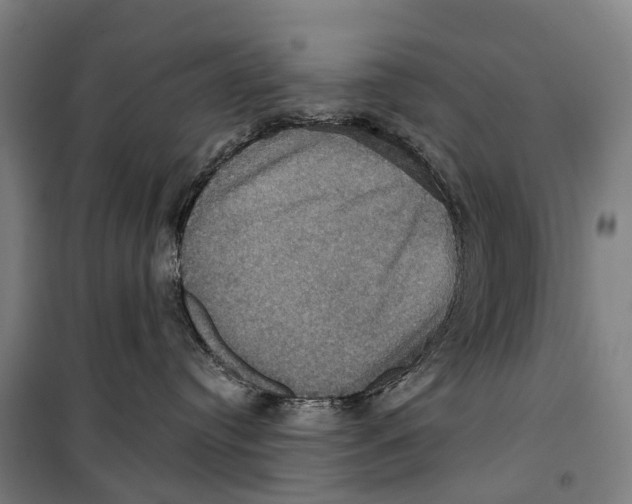 X0000099380384200806051127