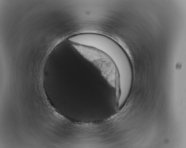 X0000099380385200806051126