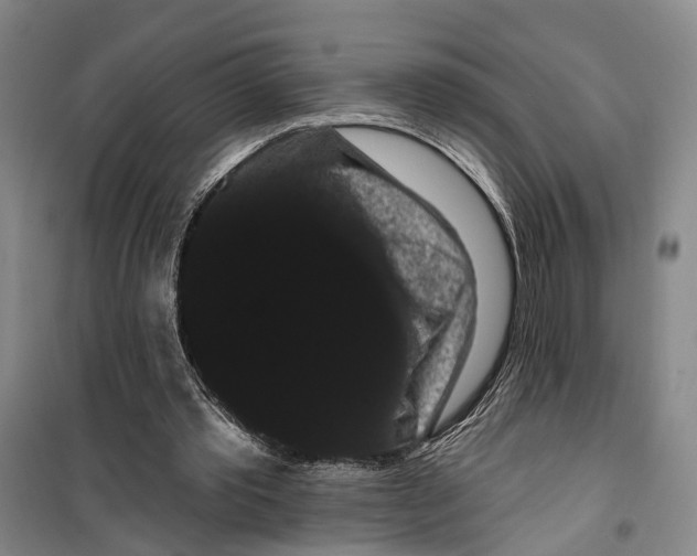 X0000099380389200806051126