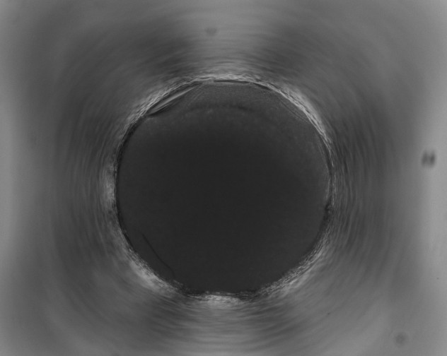 X0000099380393200806051126