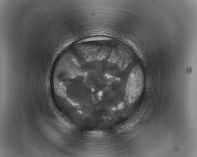 X0000099380394200806051126