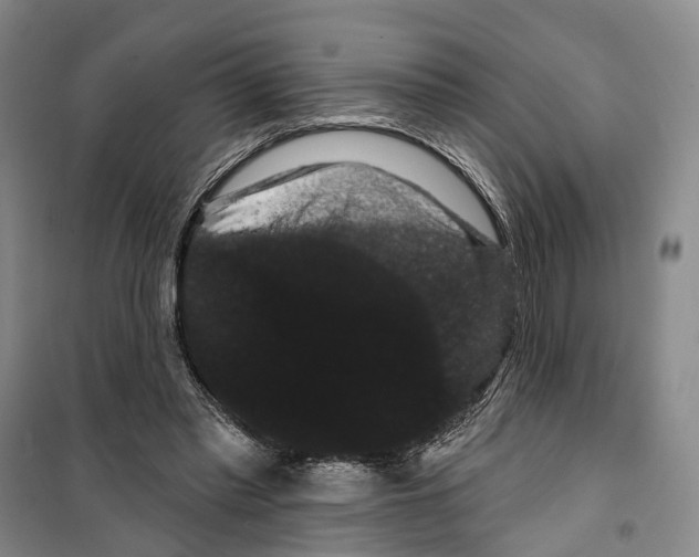 X0000099380397200806051126