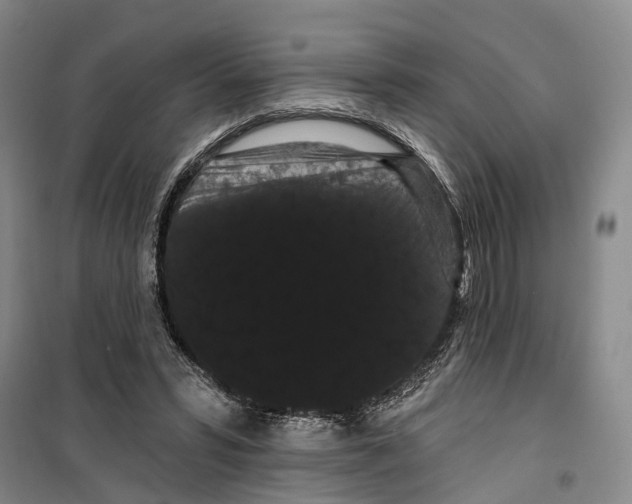 X0000099380399200806051126