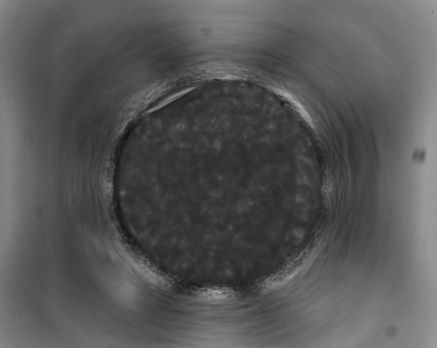 X0000099380402200806051126