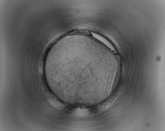 X0000099380403200806051126