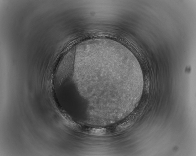 X0000099380410200806051126