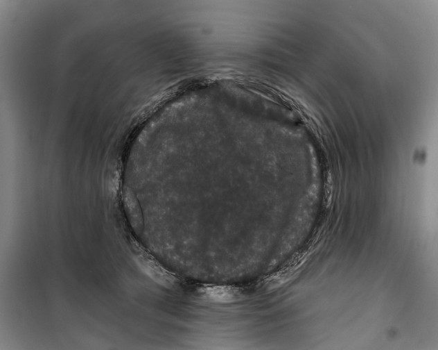 X0000099380417200806051126