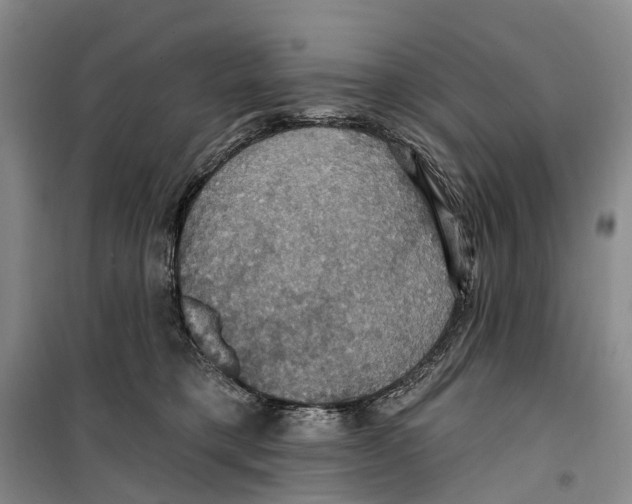X0000099380421200806051125