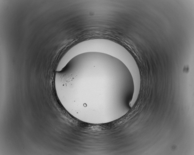 X0000099380423200806051125