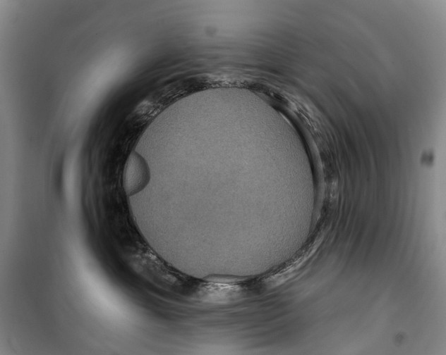 X0000099380429200806051125