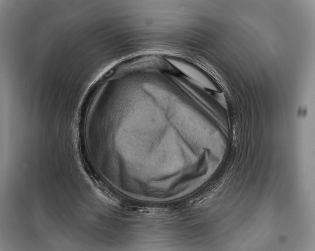 X0000099380436200806051124