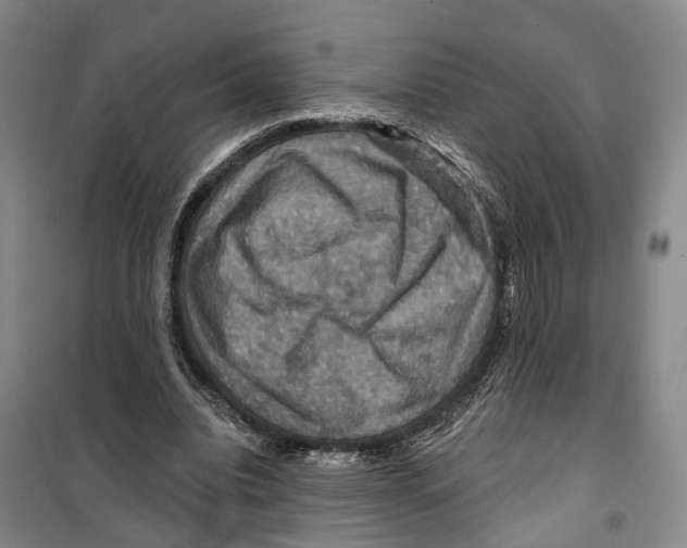 X0000099380440200806051125