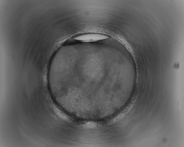X0000099380441200806051125